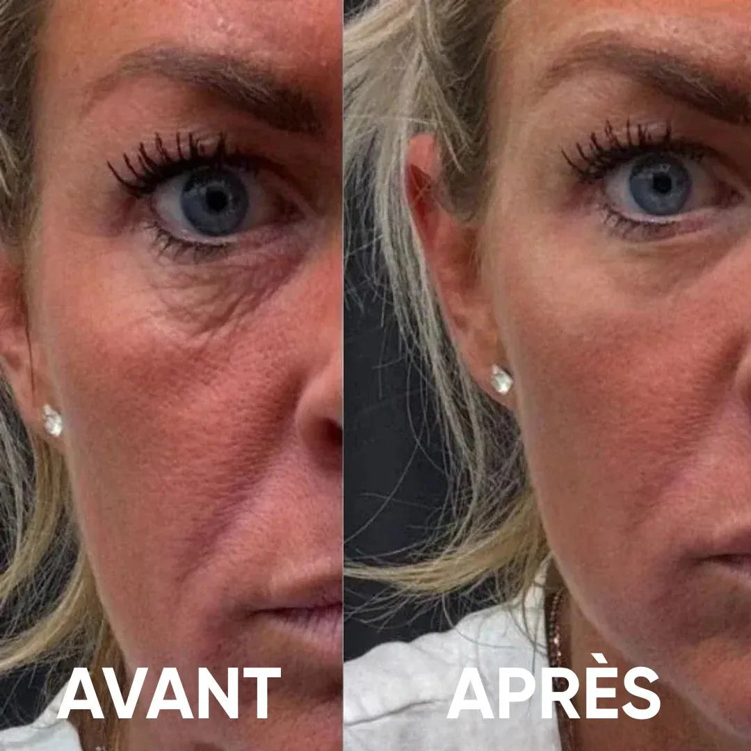 Patchs pour les yeux à base d'hydrogel de collagène peptidique