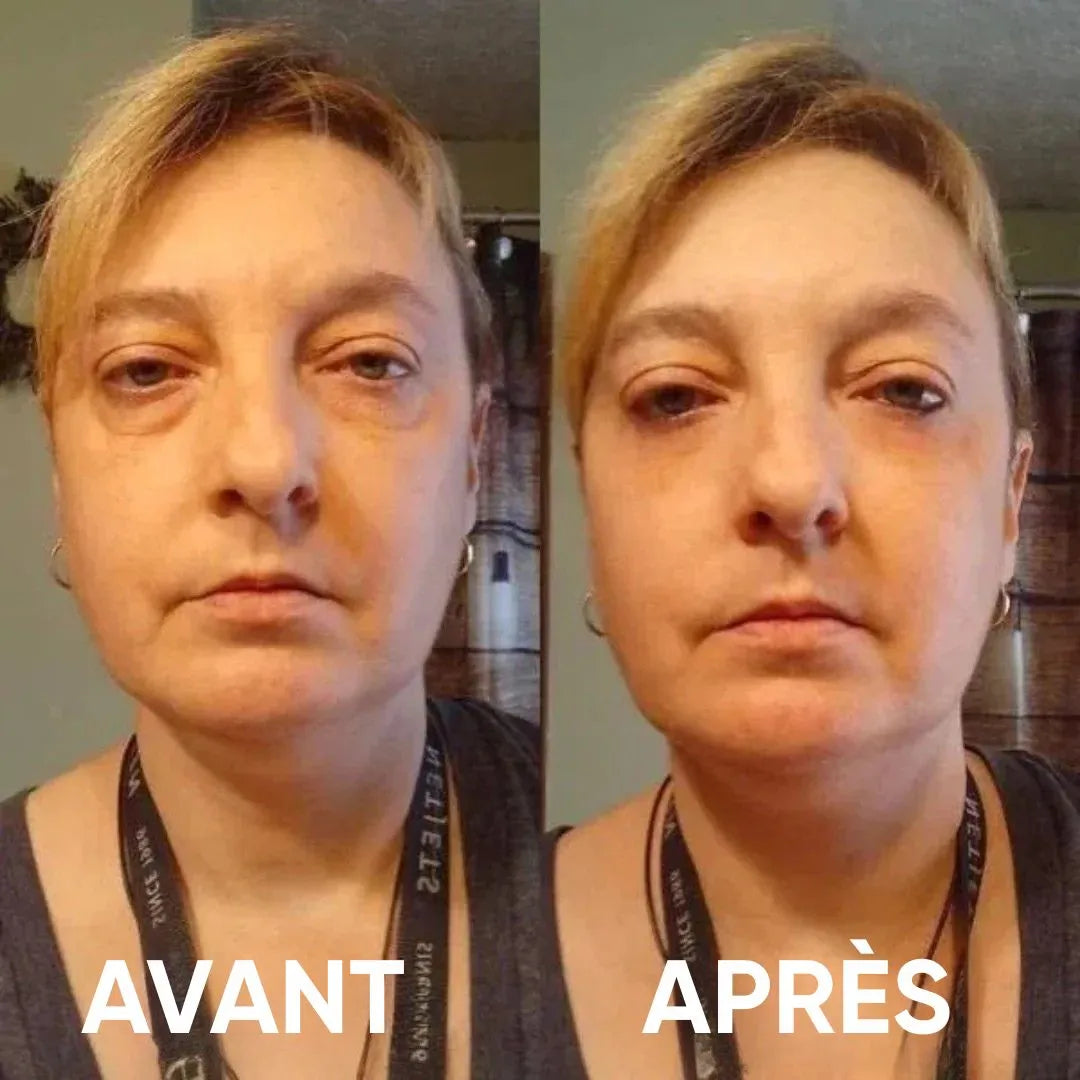 Patchs pour les yeux à base d'hydrogel de collagène peptidique