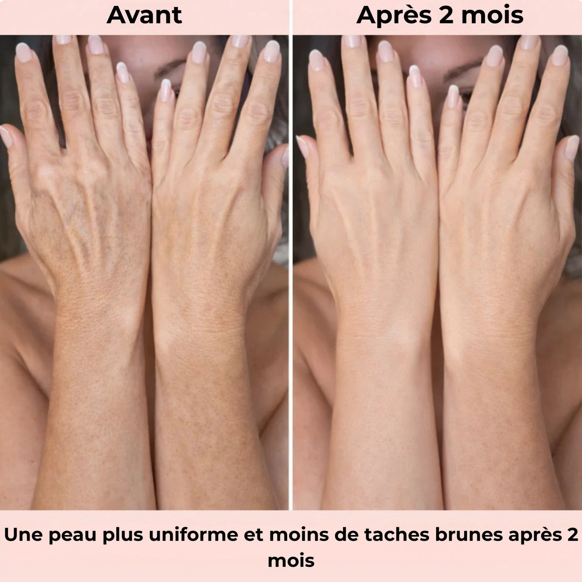 Lotion corps au rétinol "Dermavé" pour lisser la peau