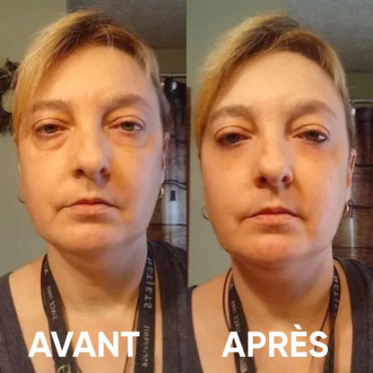 Patchs pour les yeux à base d'hydrogel de collagène peptidique