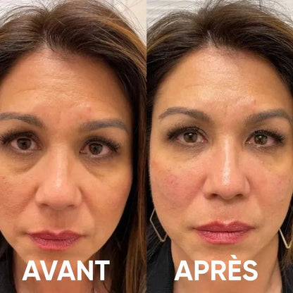 Patchs pour les yeux à base d'hydrogel de collagène peptidique