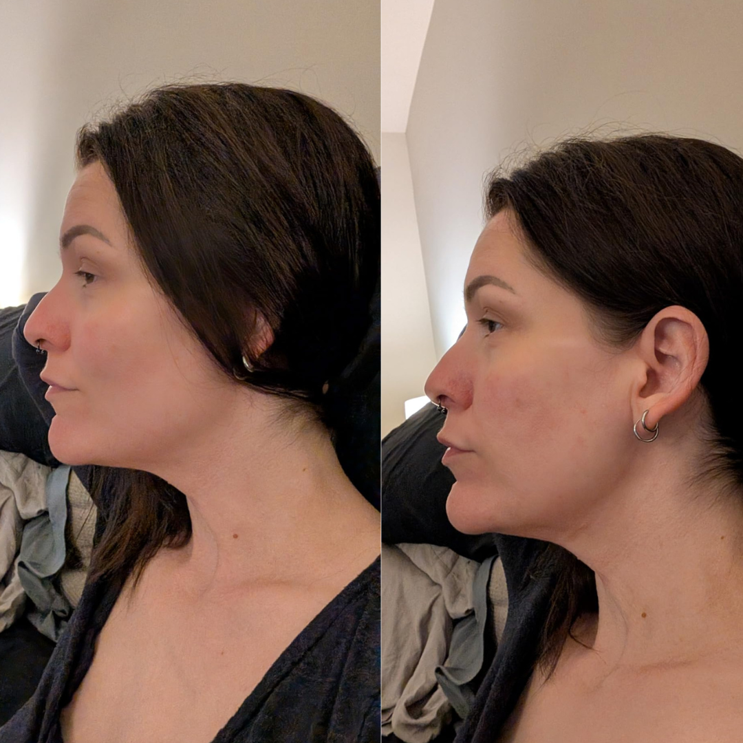 Masque collagene "KB Lift" Korean Beauty 🇰🇷